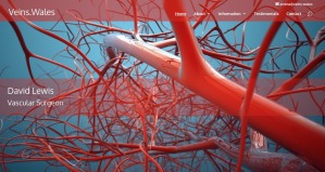 Veins.Wales (editable brochure website)